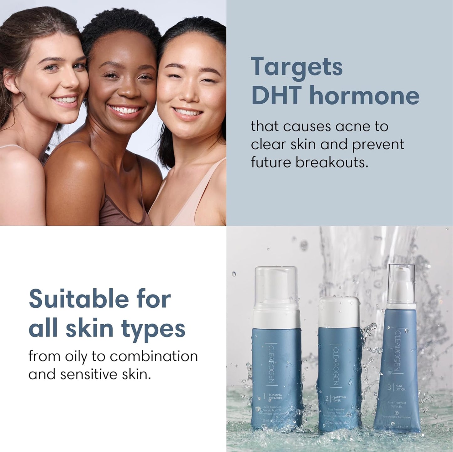 Acne Treatment Kit, Acne Kit, Skin Care Acne, Acne Skin Care Set, Natural Anti-DHT Deluxe Set Sensitive Skin 3-Piece Set, 2-Month Supply