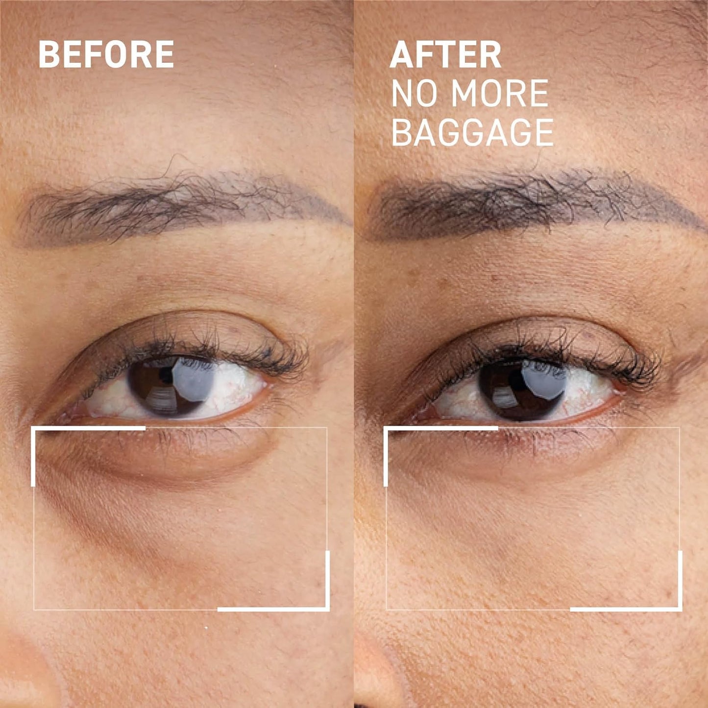 Dr. Brandt Needles No More Baggage - De-Puffs Under-Eye Bags and Brightens Dark Circles - Full (0.5 oz) + Travel Size (0.25 oz)