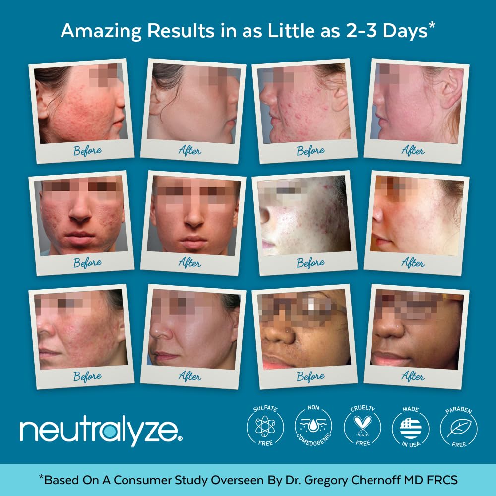Moderate To Severe Acne Treatment Kit 2.0 (Clearing Serum & Synergyzer)