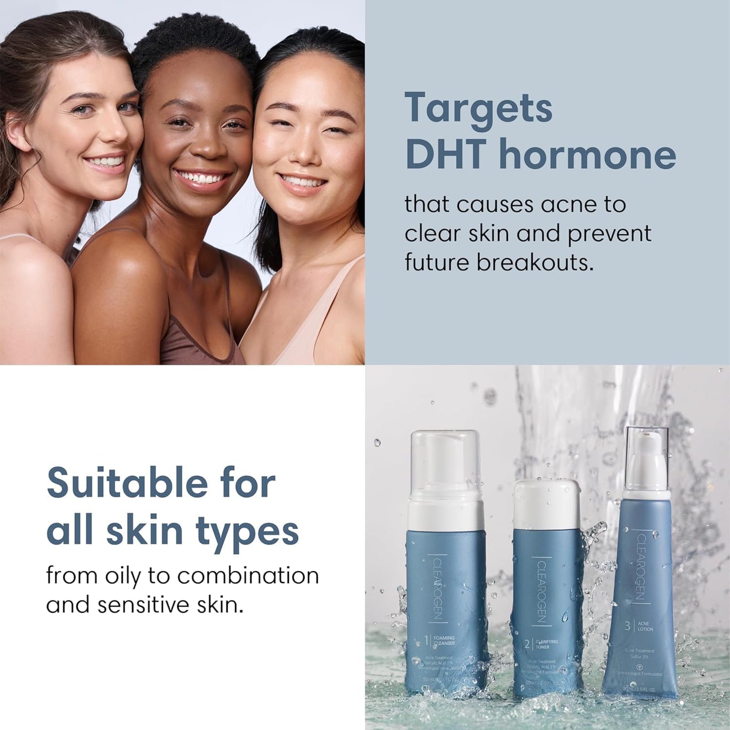 Clarifying Toner for Acne and Blemishes, Face Toner, Facial Toner, Skin Toner, Acne Toner, Toner Oily Skin, Salicylic Acid Toner, Astringent for Face, Toners, 4 Fl Oz