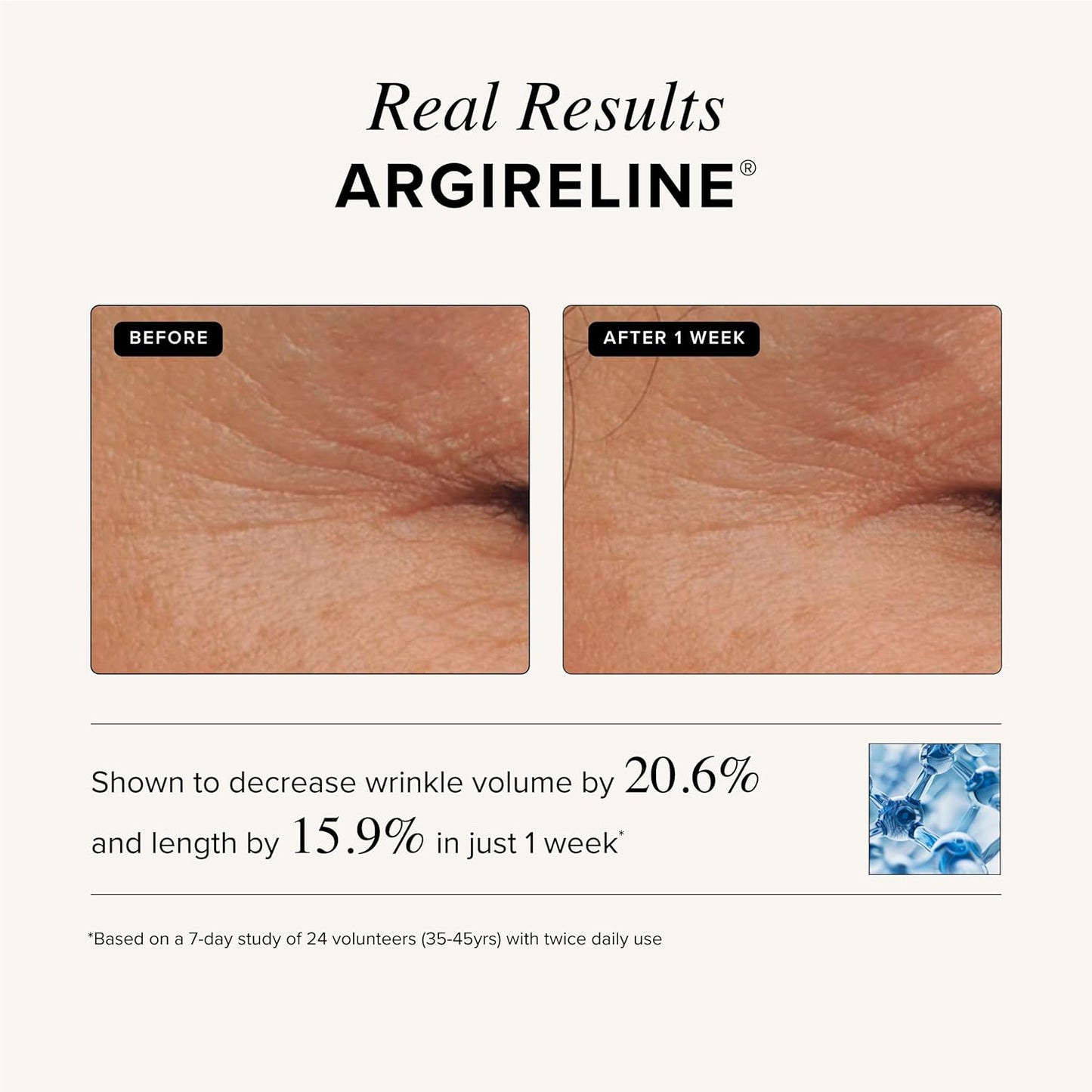 Asterwood Triple Repair Matrixyl 3000 + Argireline + Hyaluronic Acid + Vitamin C Serum for Face - Anti-Aging, Collagen Boosting, Hydrating - Fragrance-Free - 8 Fl Oz