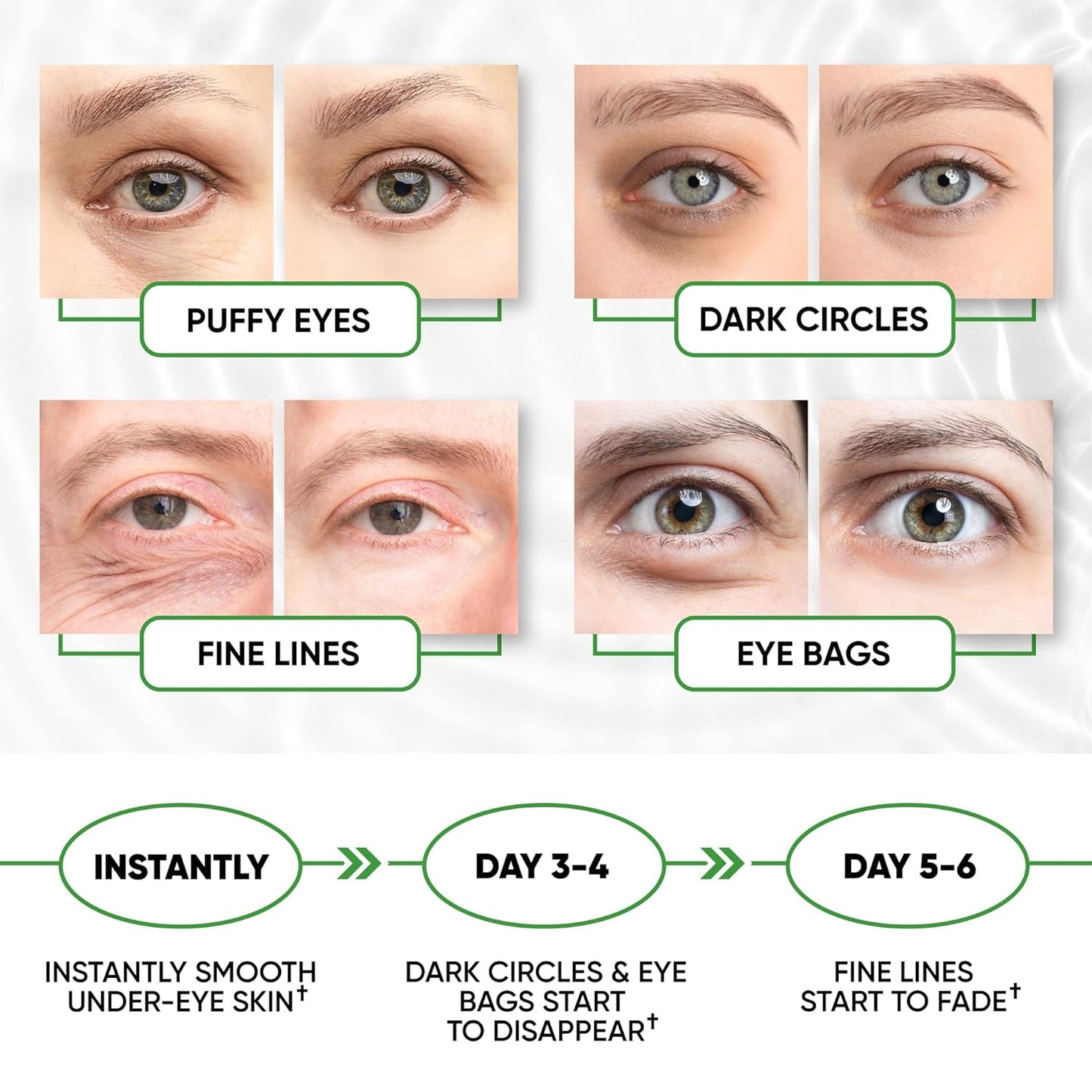 Under Eye Mask for Puffy Eyes, Dark Circles, Eye Bags, Puffiness, Wrinkles with Collagen - Hydrating - Green Tea Skincare - Anti-Aging Eye Patch Treatment Masks - 60 Under Eye Gel Pads