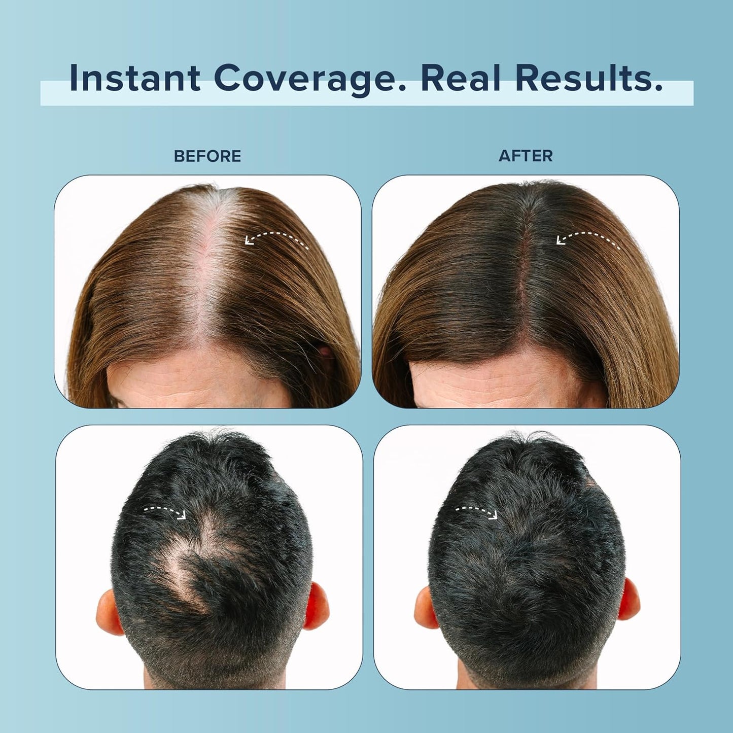 TRUHAIR Color Fibers Root Coverage & Density Booster | Quick-Apply Root Touch Up Hair Color | Natural Color Matching, Gray Hair Cover up to Color Gray Roots - 11 Hair Colors Available (White)