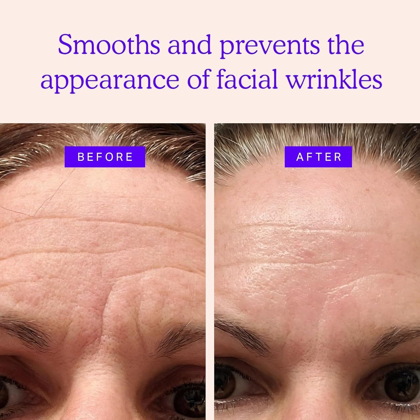 BLUMBODY Face, Forehead Wrinkle Patches – Mini Anti-Wrinkle Facial Patches for Eyes, Mouth, Forehead – Triangle Non-Silicone Face Tape for Elevens, Crows Feet and Fine Lines – 160 Facial Patches
